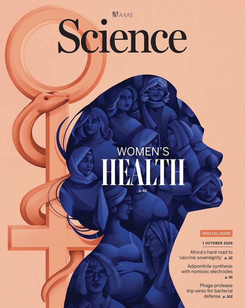 Gabrielasjr's tweet photo. Si es de las mujeres que cada vez que hacía un comentario sobre algún dolor que pudiera presentar su cuerpo, la respuesta automática del entorno era “todo es mental”, preste atención porque la ciencia acaba de derrumbar un mito de la medicina que acompañó a las mujeres durante décadas. 

La revista Science, publicó el pasado 1 de octubre una edición especial dedicada a la Salud de las Mujeres (Women’s Health), que estuvo a cargo de cuatro investigadoras: Yevgeniya Nusinovich, Sacha Vignieri, Joana Osório y Sarah Ross quienes tenían el propósito claro de su investigación: exponer públicamente la brecha histórica de género en los ensayos clínicos y la medicina en general. 

Durante décadas la academia de medicina avaló la teoría de que las mujeres tenían una menor tolerancia al dolor que los hombres. La realidad es que las mujeres poseen mecanismos biológicos, hormonales y neuroinmunes completamente distintos a los de los caballeros, como se explicó en el artículo Sex-specific mechanisms of chronic pain, que forma parte de la edición especial de la revista científica antes mencionada. 

La investigación determinó:
1.- Existencia de un dolor somático y un dolor visceral. Los dolores somáticos se exteriorizan en los tejidos externos, músculos y articulaciones. Migrañas, fibromialgia y osteoartritis (más frecuente en las mujeres después de la menopausia que en los hombres al llegar a la andropausia).

En cuanto al dolor visceral, se ubica en el síndrome de intestino irritable, dolor de vejiga, órganos internos y sobre todo en la zona pélvica y abdominal en la etapa reproductiva de la mujer.

2.- La culpa del dolor en las mujeres no es exclusiva de la ausencia de estrógenos, la prolactina también tiene su cuota, esta hormona segregada por la glándula pituitaria que al tener una mayor expresión de este gen, sensibiliza las neuronas sensoriales y dispara su excitabilidad y potencia el dolor mediado por el péptido relacionado con el gen de la calcitonina (CGRP), una molécula clave en los ataques de migraña.

3.- Existen diferencias en la forma en las cuales el sistema inmunitario le habla a la neuronas de un hombre o una mujer. 
En las mujeres, una inflamación intestinal previa puede dejar una disbiosis (alteración microbiana) persistente que perpetúa el dolor crónico. En modelos experimentales, este dolor visceral se pudo transferir a otros sujetos mediante trasplante de microbiota fecal.

En el caso de las articulaciones de las mujeres se observa una mayor concentración de quimiocinas inflamatorias (como CCL2 e IL-8) en el líquido sinovial. Esto atrae una infiltración de macrófagos sensiblemente superior a la que se registra en los hombres.

4.- Finalmente, llegamos al cerebro. A nivel periférico los nociceptores (neuronas encargadas de detectar el dolor) expresaron genes completamente diferentes entre hombres y mujeres. 

La amígdala contribuye a fijar una hipersensibilidad visceral a largo plazo que se activa con el estrés. 

Estos resultados reveladores trascienden el mero estudio sobre el dolor en las mujeres, dentro de la investigación fue decisivo realizar una advertencia, la inmensa mayoría de los datos genéticos, clínicos y biomédicos corresponden a mujeres de origen europeo. Es urgente que los ensayos incluyan a mujeres de todos los orígenes étnicos y genéticos para que la medicina personalizada sea real.  

La industria farmacéutica tiene una deuda pero también una oportunidad a partir de esta investigación. Utilizar los resultados para diseñar analgésicos que tengan en cuenta el perfil hormonal, neuroinmune y genérico de las mujeres. 

Si el tema le apasiona le recomiendo la lectura de esta edición especial de la Revista Science dedica en exclusiva a la salud de la mujer. 

#CienciaParaLaVida #SaludDeLasMujeres #DolorCrónico #Neurociencia