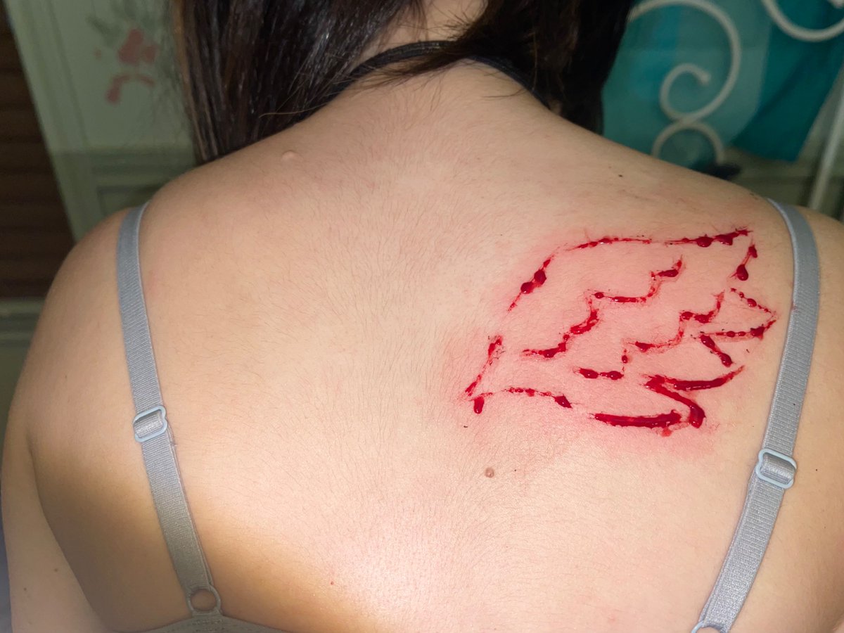 1ofThseCrzyGrlz's tweet photo. never left a mark but it was cool for a bit. also this photo is a weird angle and unflattering.. 😅😕

#shtwt #angel angel wing scar 

 X, its all fake scar halloween sfx ai content not real https://t.co/Udz0BRjunS