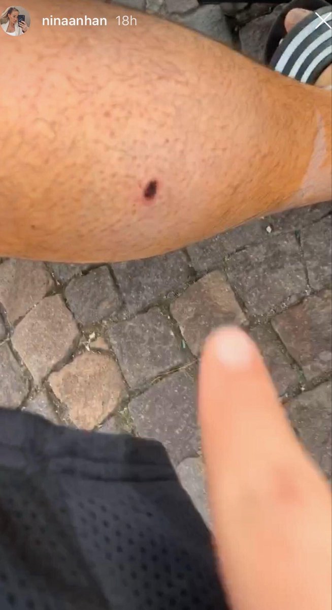 ariankertalli's tweet photo. da hab ich mir wohl ins eigene bein geschossen https://t.co/AA99wRBxyQ