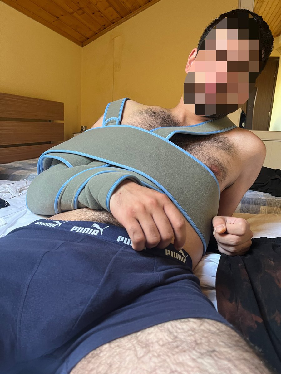 homoeroticlove's tweet photo. I HAVE RETURNED HOTTER THAN EVER. 

Two months ago, I was ATTACKED by Ukrainian neo-nazis for being a COMMUNIST. I broke several bones in my beautifully hairy body, which explains my disappearance, but that has only motivated me to go further. 

For this reason, I have therefore started an OF, to be able to further my degenerate activities. 

FUND THE REVOLUTION! Link in bio!
#NSFW #hairy #gay