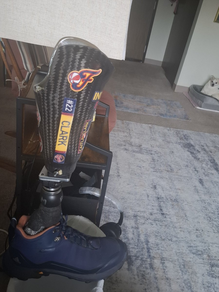 MrSpiritsRaven's tweet photo. I WILL Always & FOREVER BE A FOLLOWER of @CaitlinClark22
As a #RightBelowKneeAmputee I have my #ProstheticLeg🦿 #CaitlinClark
But I AM Completely Finished WITH The #WNBA
I CANNOT in Good Conscience SUPPORT An Athletic Association or a League that TREATS its #GenerationalPhenom like Garbage 🗑️ in favor of a #Racist #Sexist #BULLY who's NOTHING but a #PhonyAss #MarshmallowPuff
#AjaWilsonWHO
#AjaWilson @_ajawilson22 is #Toilet 🚽
#Paper 🧻