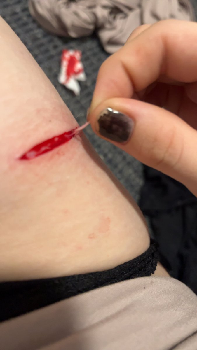Somebitch_101's tweet photo. I’ve been clean for like a year I just relapsed but I don’t fucking know why. I haven’t felt much recently except for happy. I’m not even homesick yet. This was so random. What the fuck is wrong with me why can I not just fucking move on. I don’t fucking understand. https://t.co/qgHwjgR7sj