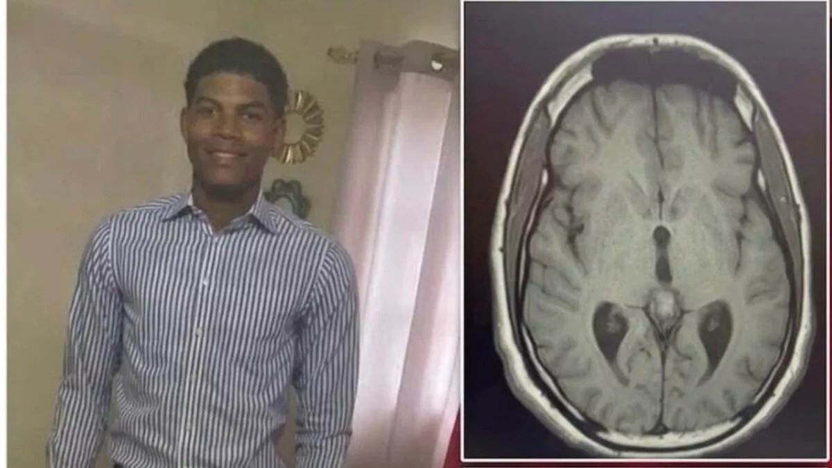 SIN24Horas's tweet photo. Adolescente de 16 años enfrenta tumor cerebral y pide ayuda para ser pelotero #NoticiasSIN

Detalles en:
https://t.co/tavQlASmcz https://t.co/N5tiFgWzaW