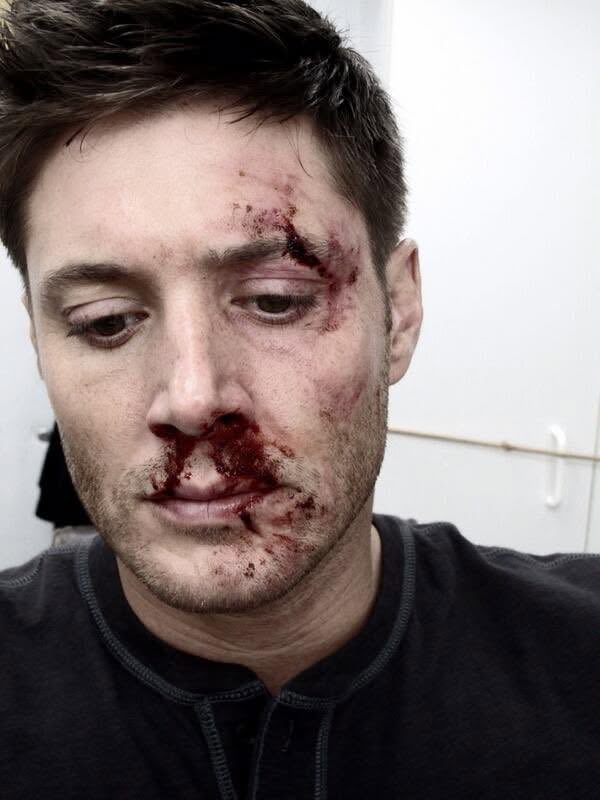 deanphilia's tweet photo. they should’ve made him bloodier more often https://t.co/n83vZg7yfL