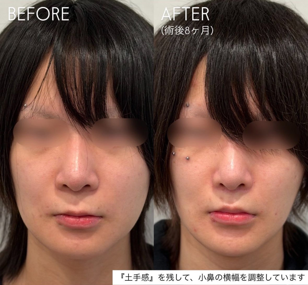 remonsouwer55's tweet photo. この症例ナチュラルだなー https://t.co/9GEY57U50w