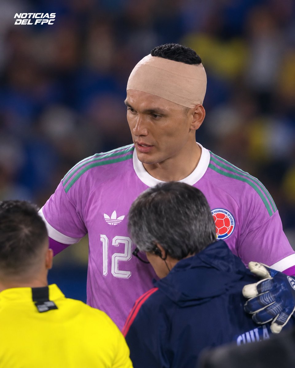 Noticiasdelfpc_'s tweet photo. ¡DEBUT A LO GUERRERO! 🤕

Aldair Quintana tuvo su primera aparición con la Selección Colombia y apenas 6 minutos después tuvo que ser atendido tras sufrir un corte en la cabeza

Pero el no quería perderse este momento. Es el sueño de toda una vida. y no iba a renunciar tan fácil https://t.co/Hs4tzruFn4