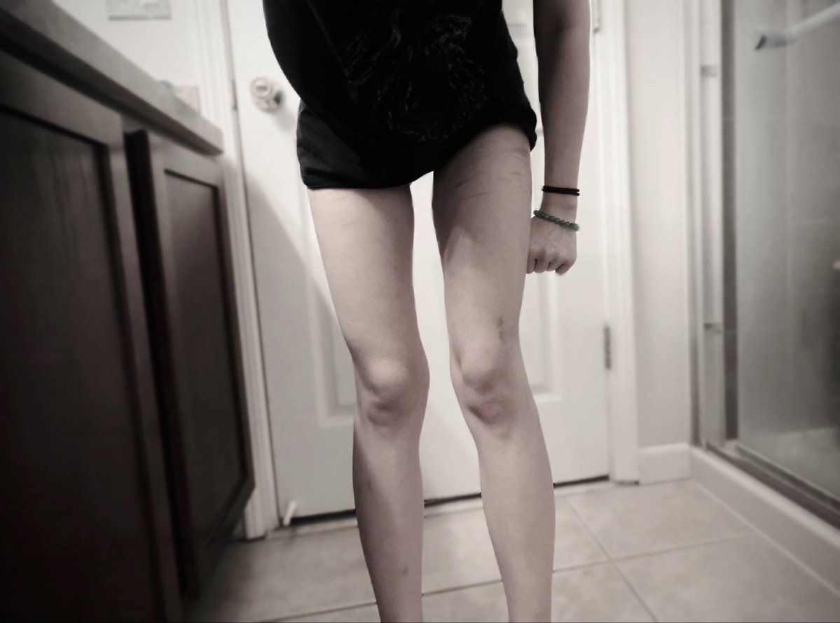 exotic_friut's tweet photo. #edrtwtㅤ #ricecaketwt #bodycheck 

bc from a few days ago 🪽
i like my legs in this https://t.co/CLK9k1huJD
