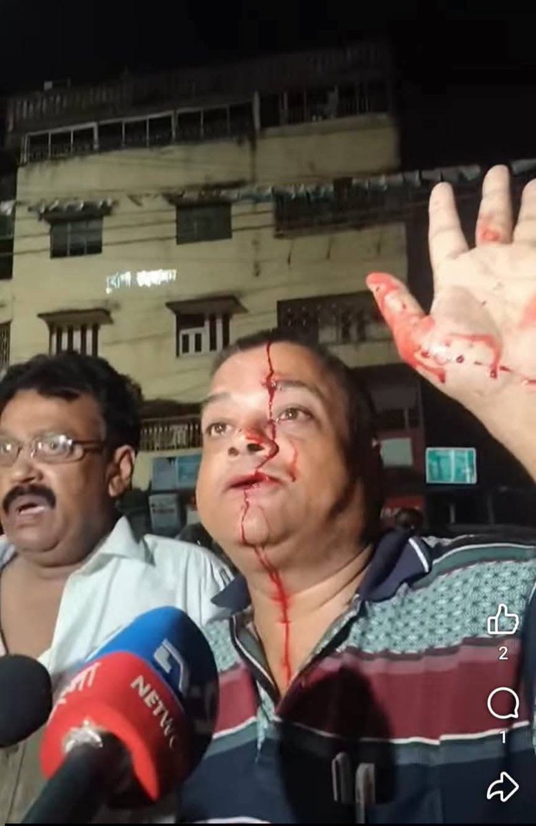 cpimspeak's tweet photo. An SFI rally at Birati in North 24 Parganas, West Bengal, was targeted by BJP goons despite having all necessary police permission.
The goons tried to disrupt the programme by disconnecting the sound system and threatening SFI activists. When the meeting began in the evening with a battery-operated microphone, BJP goons returned in large numbers, ransacked the stage and brutally attacked SFI activists and the assembled crowd with iron rods and tube lights. A chair was also hurled at Comrade Dipsita Dhar.
Fifteen SFI leaders and workers were injured. When District Committee member Comrade Shivshankar Ghosh intervened to protect the activists, he was struck on the head and required five stitches. Eight activists were taken to hospital, with four later shifted to hospitals in Kolkata. Comrade Shuvankar Das suffered a serious eye injury.
Even on Gandhi Jayanti, the BJP goons did not spare Mahatma Gandhi's portrait, smashing it to the ground.
While those responsible for the attack remain at large, police arrested three SFI activists, including the District Secretary.
Later, senior CPI(M) leaders, including Central Committee member Comrade Sujan Chakraborty, District Secretary Comrade Palash Das, and State Committee members Comrade Atreyee Guha and Comrade Gargi Chatterjee, visited the spot. See less