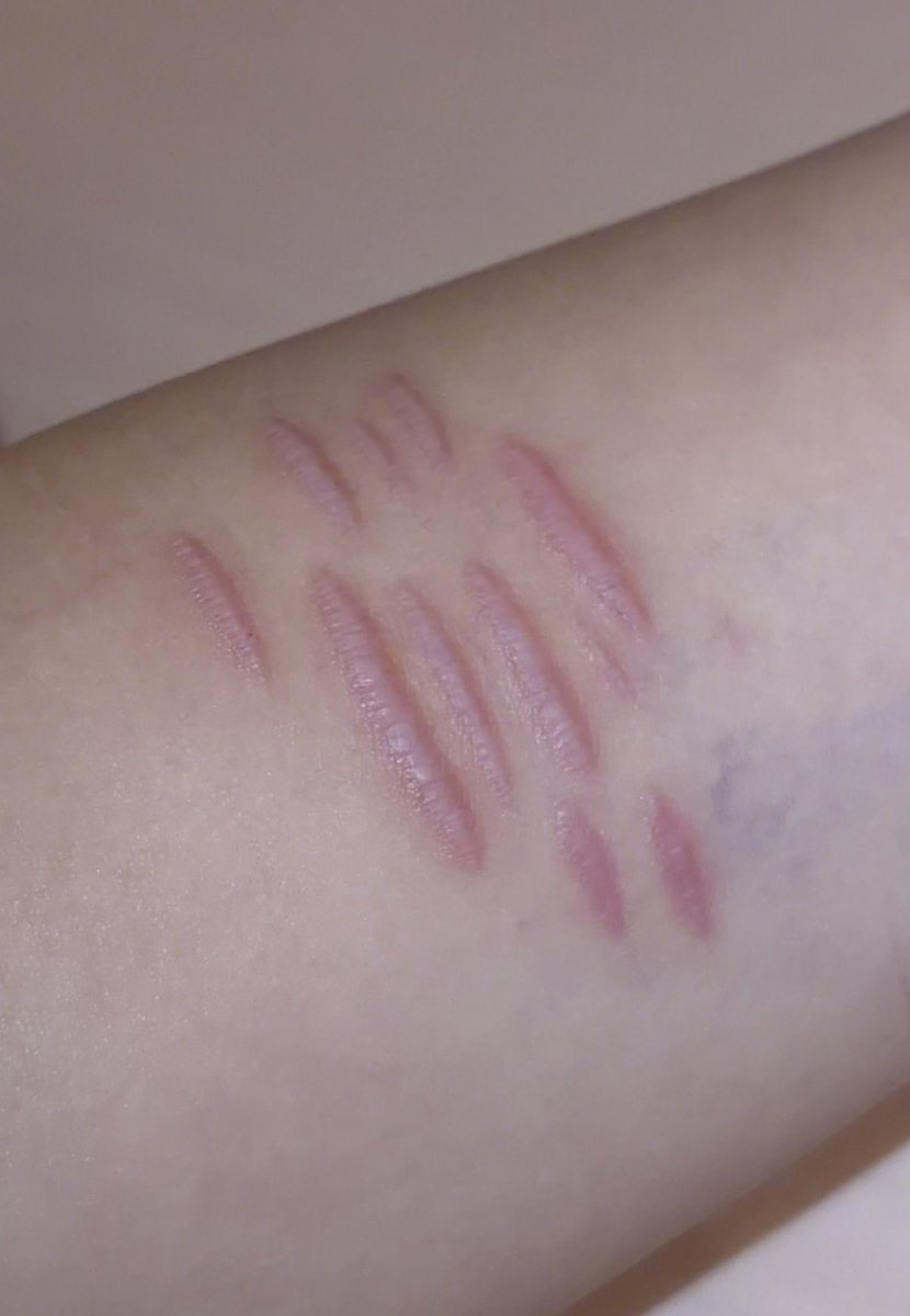 stuckkinaditch's tweet photo. i’m back🫩✌🏻
small styro+healed scars from last month 
ALL MAKEUP/SFX/FAKE #shtwtt #cuts https://t.co/7vuIXAZGRo