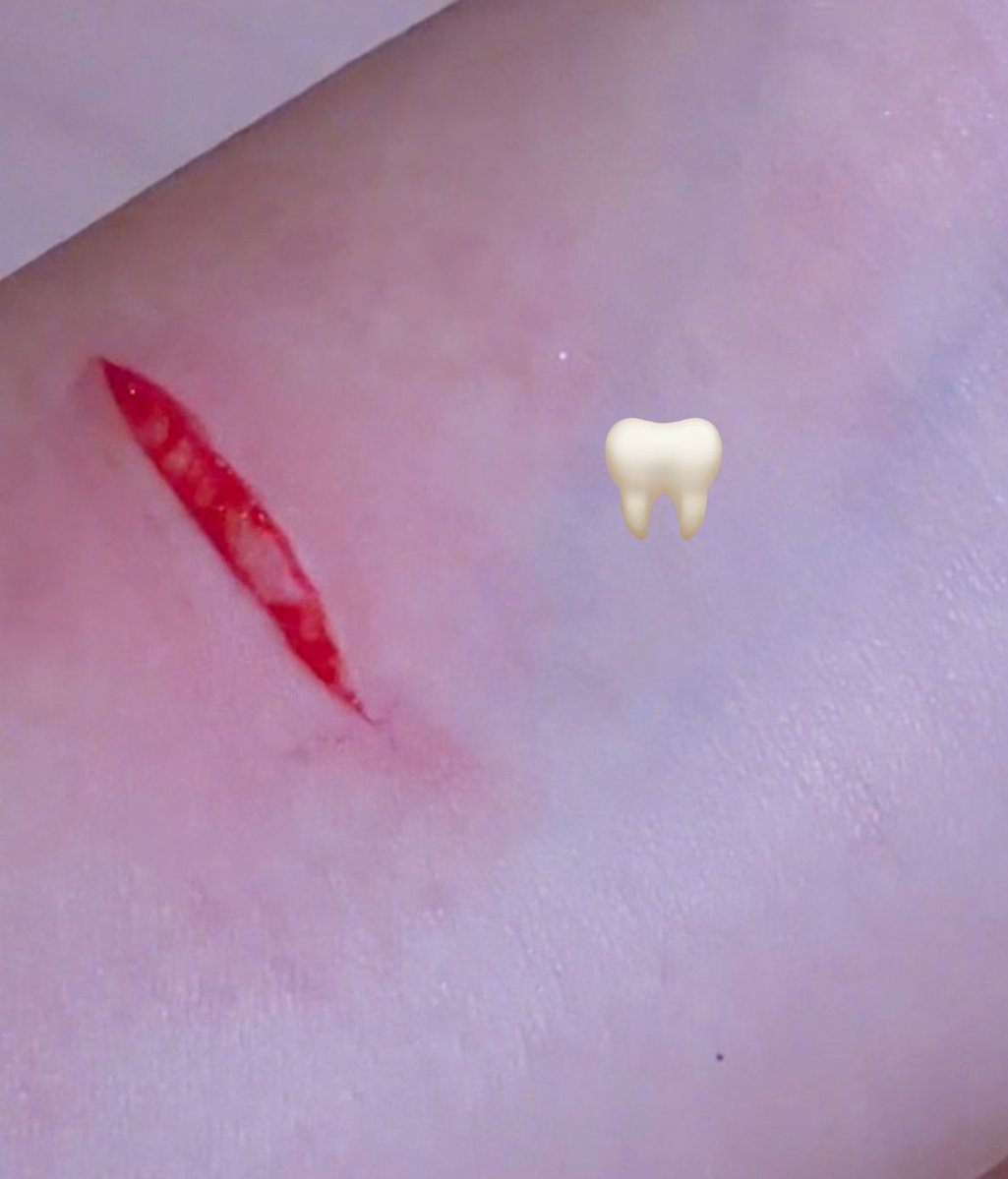 stuckkinaditch's tweet photo. i’m back🫩✌🏻
small styro+healed scars from last month 
ALL MAKEUP/SFX/FAKE #shtwtt #cuts https://t.co/7vuIXAZGRo