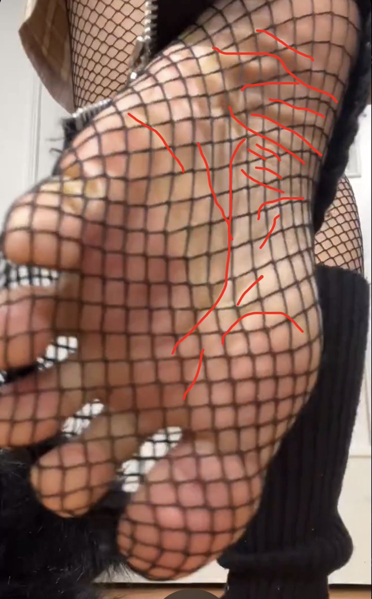 Wrinkle_Counter's tweet photo. @MisaQueenxoxo You’re getting about 16-22 depending on how they connect. https://t.co/73QDPA3MyI