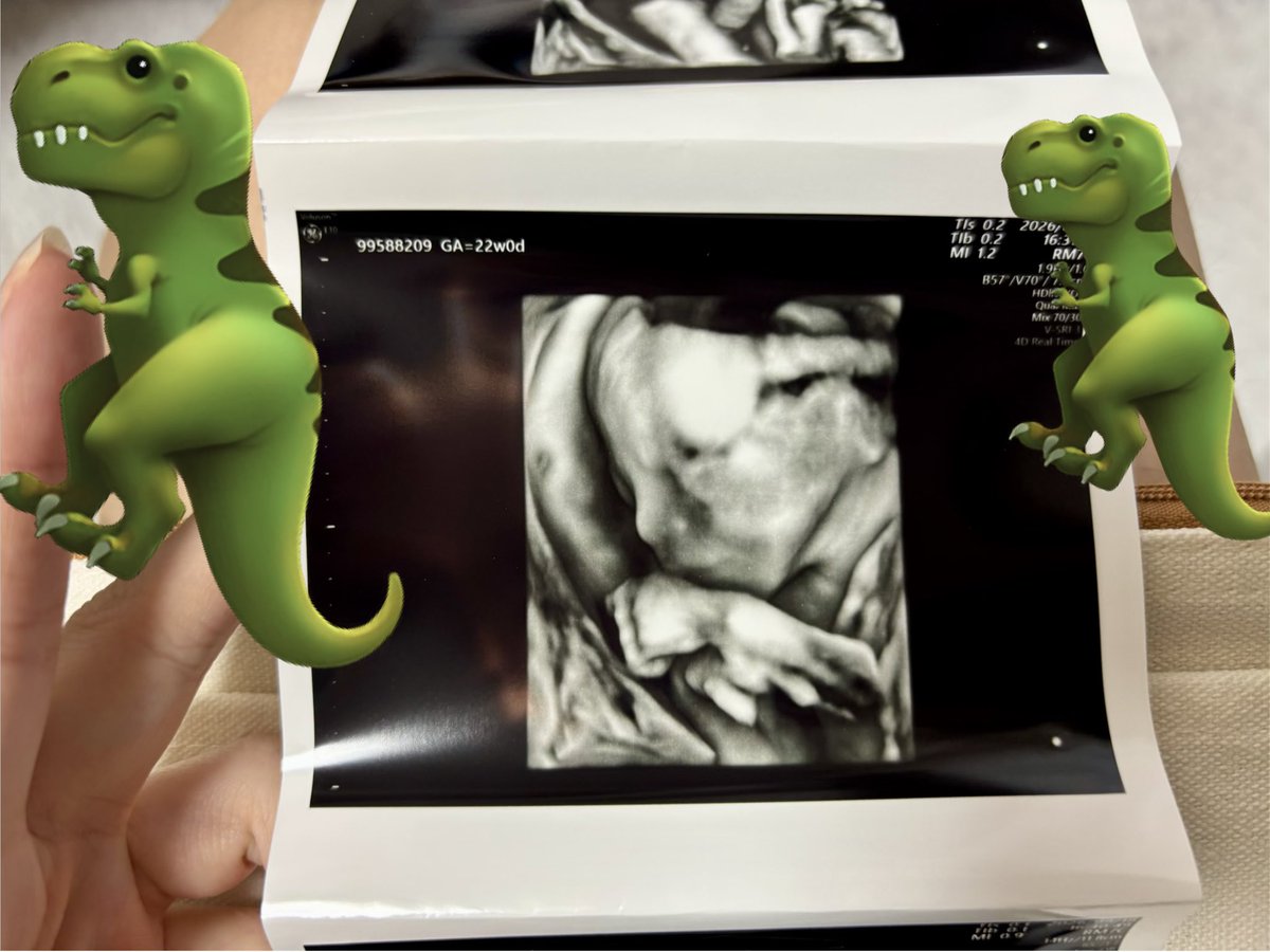 psesenp's tweet photo. 早いものでもう7ヶ月👶
トラブルはあったけど私の体重は7kg増加し赤ちゃんは650gになったよ🏋️‍♀️ https://t.co/4hvtl5NXZL