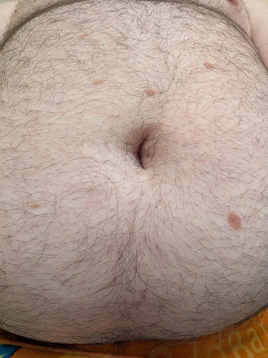 BellyMattuk's tweet photo. Come play with me 😭 https://t.co/JLq8rF1lec