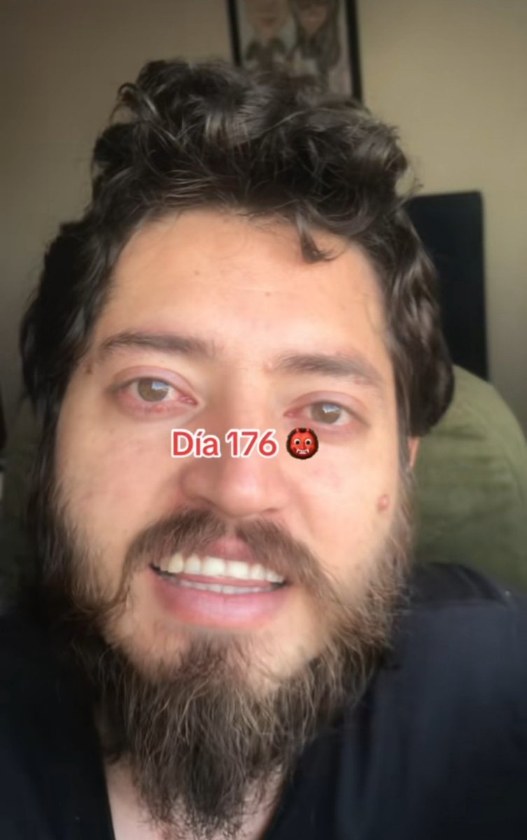 futbismo's tweet photo. Hay un hincha del América en tik tok que está haciendo el reto de no cortarse el pelo hasta que el América gane 5 partidos seguidos.

El tipo es tan salado, que América no ha podido y el Cali ya gano los 5 seguidos 😭. https://t.co/d6RnjhAiee