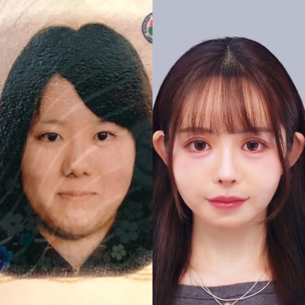 高校生から今の変化すごいから見て。
右は去年撮った証明写真。
最近やっと顔のコンプほぼなくなった。
・全顔整形(脂肪吸引、豊胸も)
・ダイエット(マイナス9kg)
・肌質改善(イソトレ、エンビロン)
・髪質改善
・メイク研究
元々ブスだったからめっちゃ努力した。 https://t.co/voWsY4SpXn