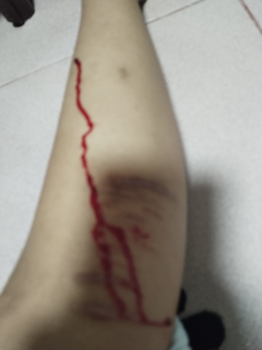 Pullibully's tweet photo. How did this little ass cut bleed so much bro
#shtwt https://t.co/FlhMhSq9Du