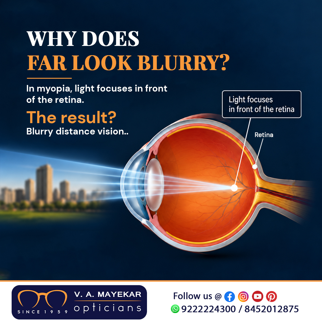 VAMayekarOptics's tweet photo. Myopia can cause blurry distance vision. Signs include squinting, blurry road signs, or sitting closer to screens/boards.
Notice changes in your vision? Get your eyes tested at V. A. Mayekar Opticians.
📍 Thane & Mumbai | 📞 9222224300
#Myopia #EyeCare #ClearVision #EyeTest https://t.co/iDTWrwt5uA
