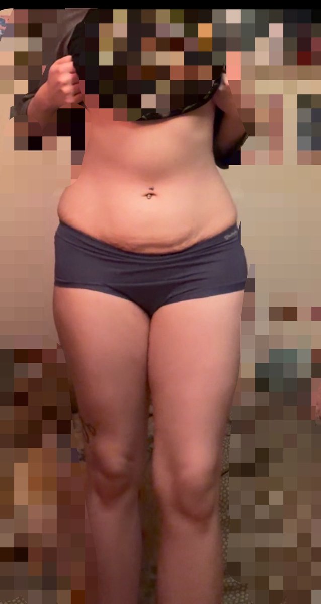 briarfields's tweet photo. June to September before and after!! 28lb difference. Please tell me it’s noticeable 😭 

#edrtwt #bc #beforeandafter https://t.co/ppIyvqSIaR