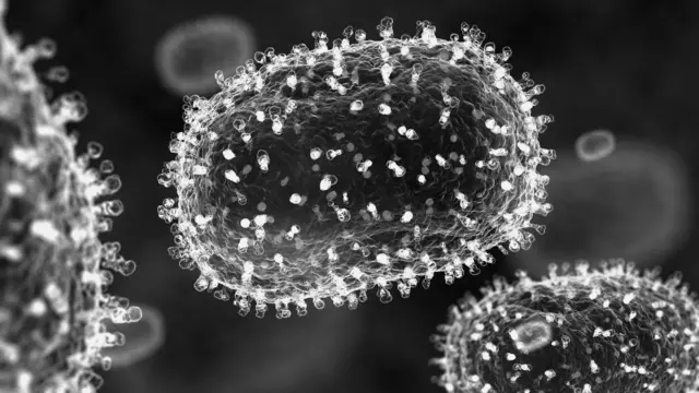 estelsiplanetes's tweet photo. El virus de la verola es va declarar com erradicat l'any 1980. Poc abans, un terrible accident a UK havia causat la darrera mort a causa la contaminació provinent d'un laboratori. Llavors l'OMS va demanar q es destruissin totes les mostres al món.

Però romanen 2 laboratoris, un als EUA i l'altre a Rússia, que en mantenen.

Demà diumenge, a les 7:30, a "La Terra és plana" #elSuplement @CatalunyaRadio