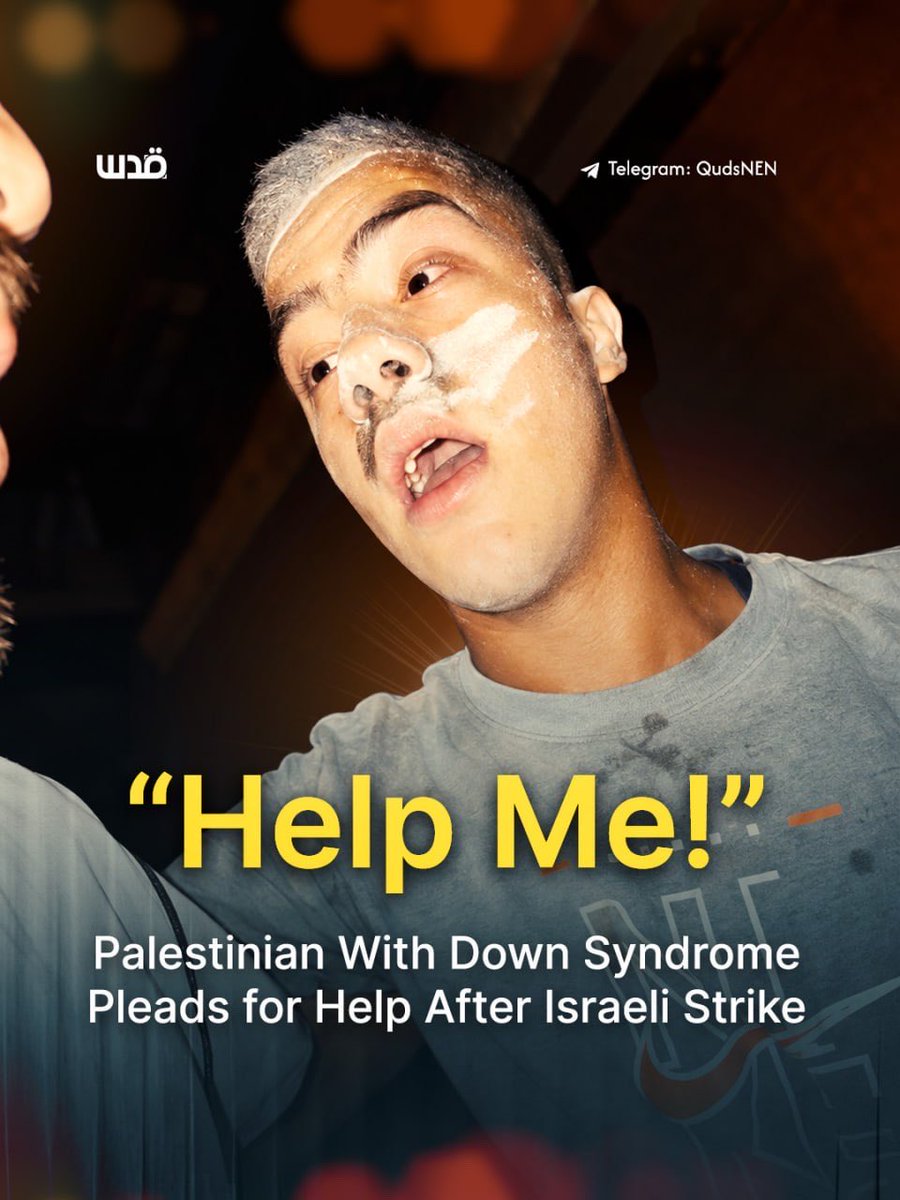 QudsNen's tweet photo. A Palestinian youth with Down syndrome is seen pleading for help following a deadly Israeli strike that killed five people and injured several others.

His distress is captured in a heartbreaking moment as he calls out to a journalist for help. https://t.co/1qiYaKMe5h