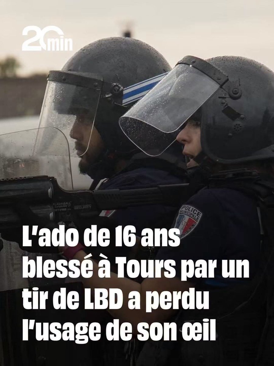 PDohen's tweet photo. La violence d'état elle est là !
Les responsables sont ceux qui sont au pouvoir !
Les lésions de l’adolescent sont « compatibles avec l’impact d’une balle de défense de type LBD », a indiqué la procureure de Tours ce vendredi.
#Lycées #France #RepressionPoliciere #Police https://t.co/MWgayvIlvr