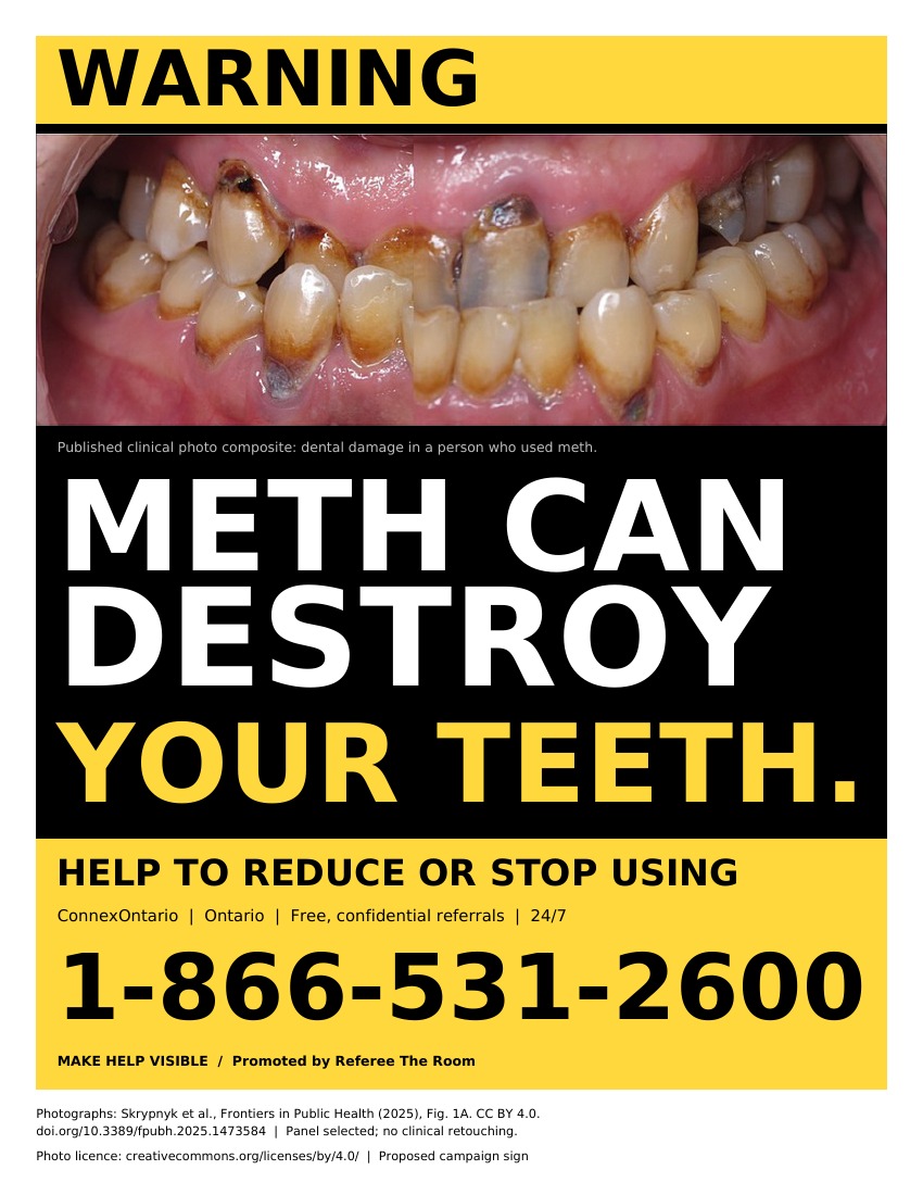 RefereeTheRoom's tweet photo. Cigarette packages carry health warnings. Shouldn’t every drug consumption site be required to display them too?

Clear warnings. Treatment contacts. Placed prominently so people can see.

Let’s make help visible. Visit https://t.co/Xxy2obyTrr https://t.co/zbQUkd8LYi