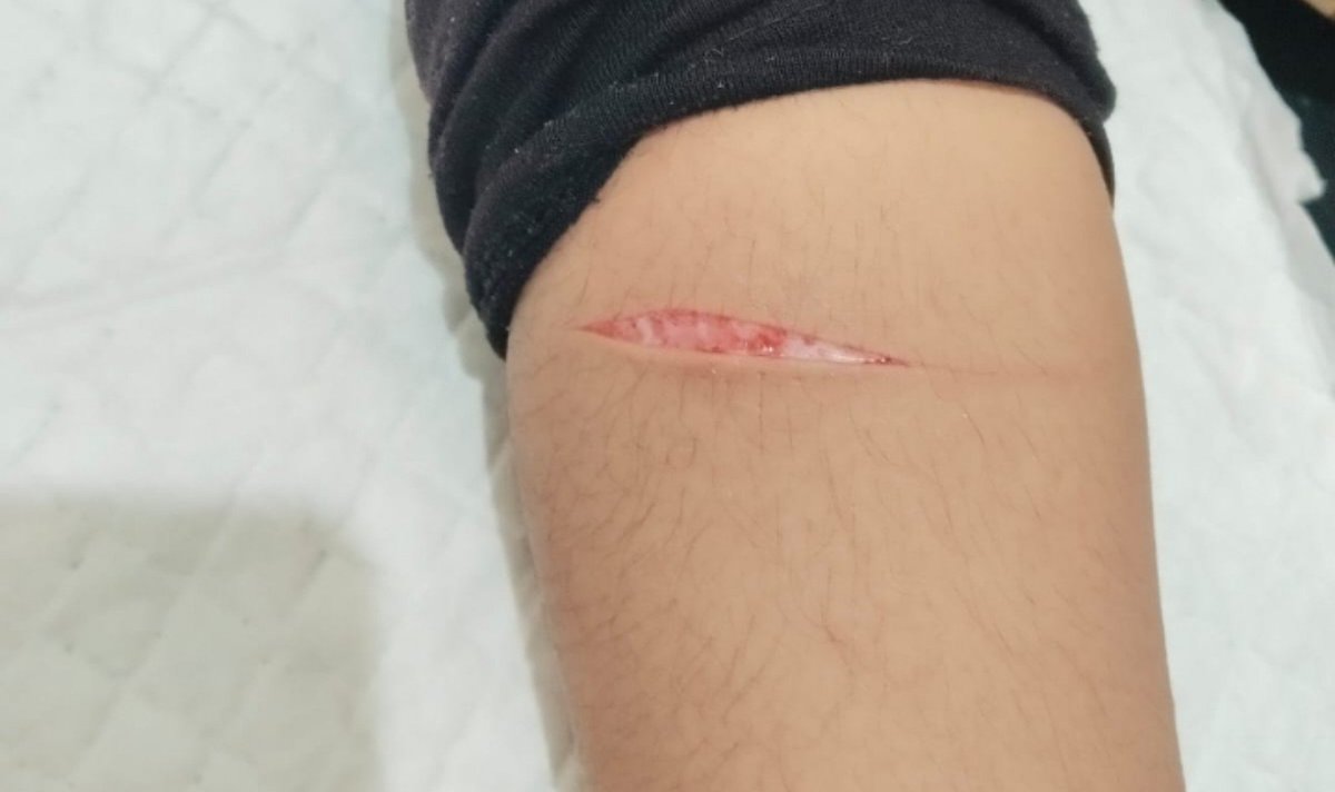 its_Destinazz2's tweet photo. Posting this again, my first ever styro 

REALISTIC SFX MAKEUP, EVERYTHINGS FAKEEE https://t.co/7ulmw3qvbk