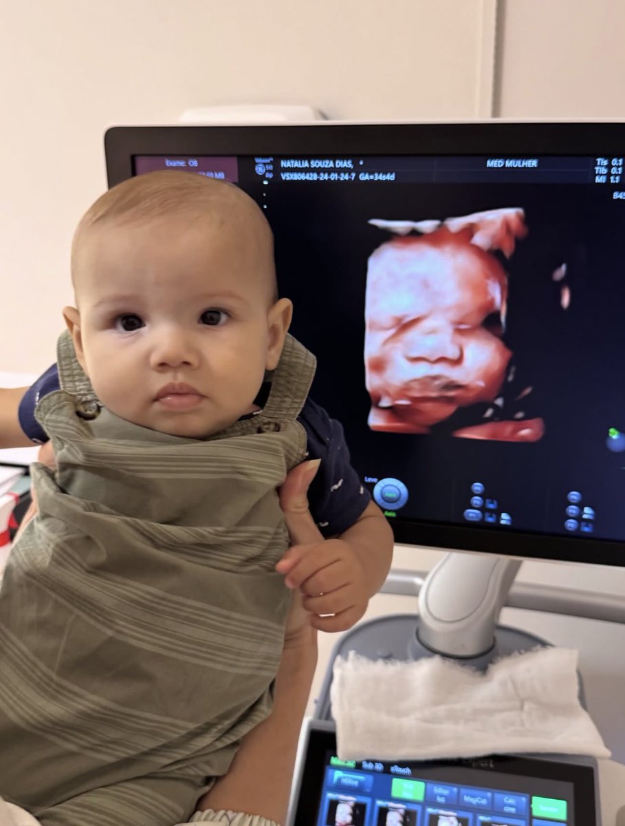 metrofive5's tweet photo. Is there anything more exciting than seeing a baby’s face on an ultrasound and then months later seeing that exact same face after birth? 🥹❤️ https://t.co/4NRAP88wQp