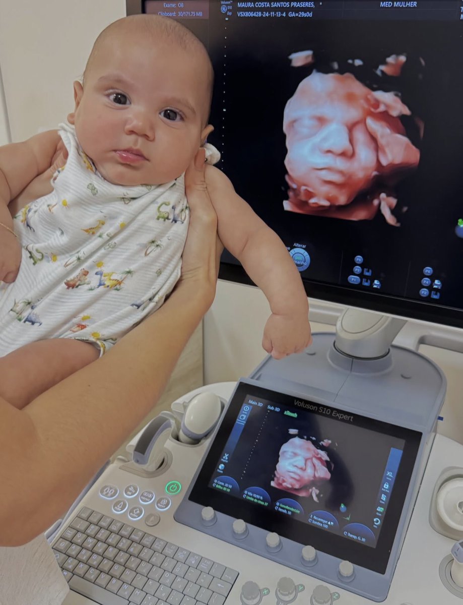 metrofive5's tweet photo. Is there anything more exciting than seeing a baby’s face on an ultrasound and then months later seeing that exact same face after birth? 🥹❤️ https://t.co/4NRAP88wQp