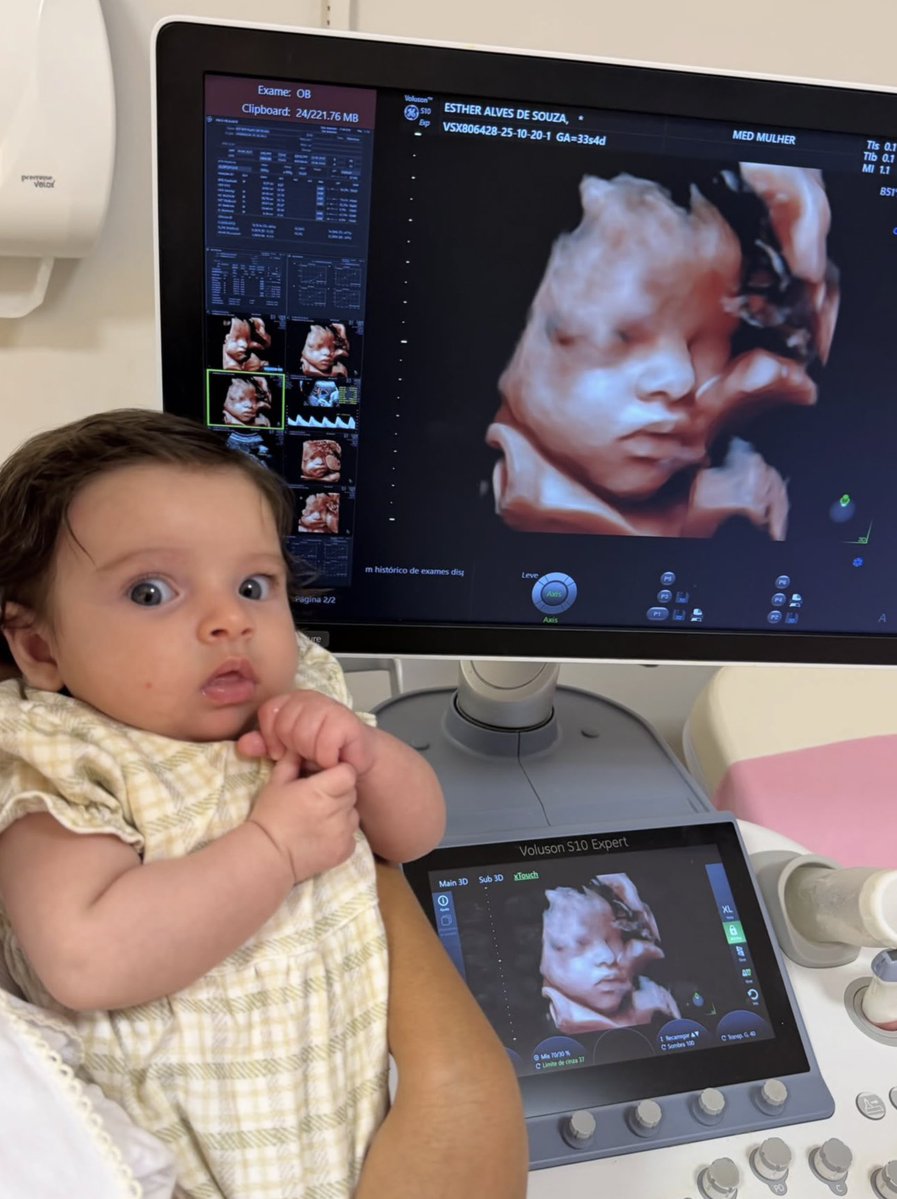metrofive5's tweet photo. Is there anything more exciting than seeing a baby’s face on an ultrasound and then months later seeing that exact same face after birth? 🥹❤️ https://t.co/4NRAP88wQp