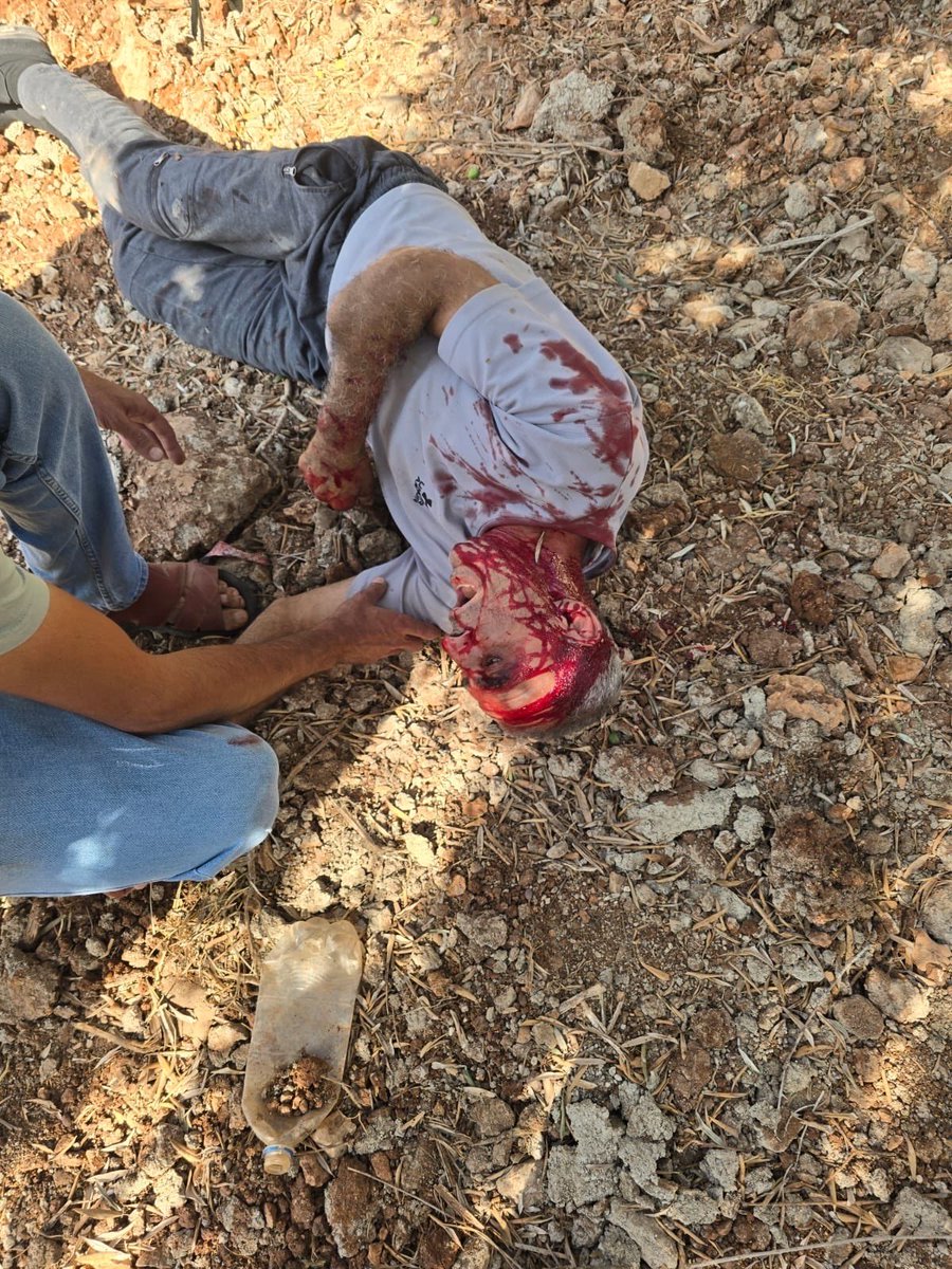 QudsNen's tweet photo. Breaking | A Palestinian was injured after Israeli settler militias beat him up in Osarin village, south of Nablus, in the occupied West Bank. https://t.co/IkOw7Fc72f