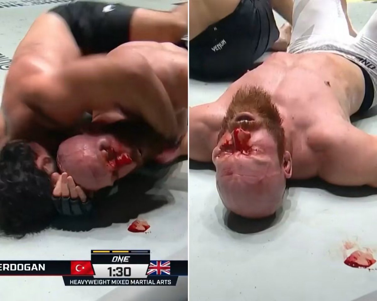 OutOfC0ntextMMA's tweet photo. THERE’S LITERALLY A PIECE OF HIS FACE ON THE CANVAS 

Shamil Erdogan 🇹🇷 moves to 14-0 and makes it SIX straight finishes in ONE after choking out Paul Elliott with a rear-naked choke! 🏆 https://t.co/4kF5eFAfJV
