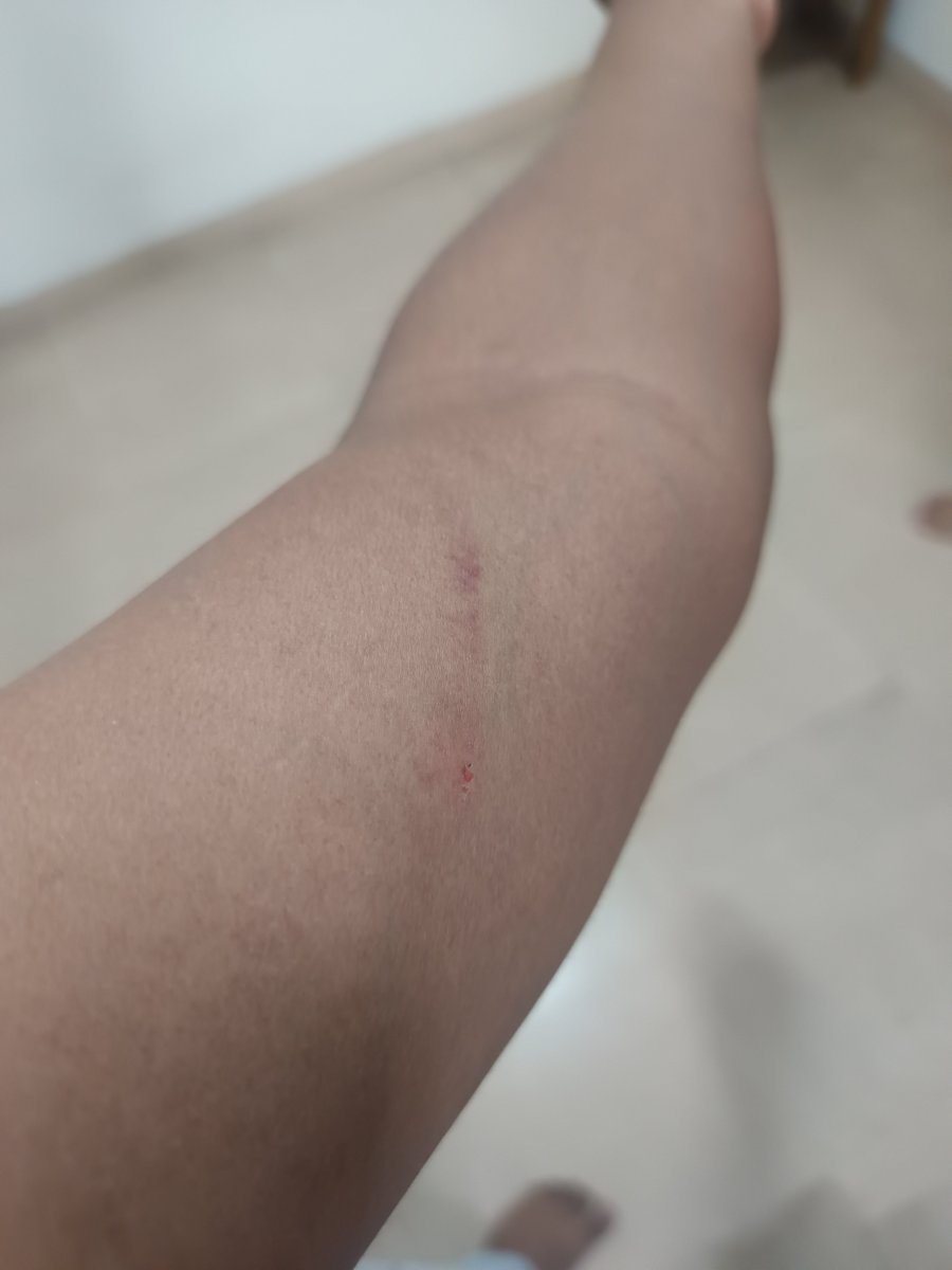 Vinitakdpw's tweet photo. @MumbaiPolice Wadhwa Wise City Shedung Panvel Sales people hit me with weapons. Half murder chi case aahe. Please call me on 7977682191 https://t.co/rtOJIPSVaE