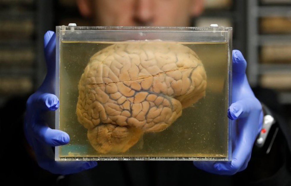 Curiosityproo's tweet photo. JUST IN🚨: Scientists have successfully detached the human brain from the living body.    

Fully detached, yet still actively functioning. https://t.co/av5hK0R68U