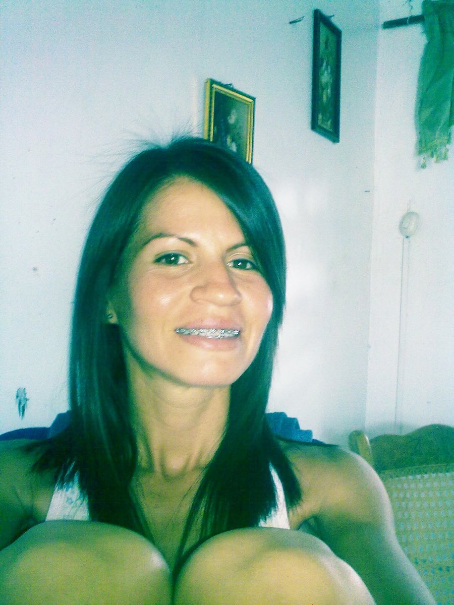 LiliithSweetX's tweet photo. Antes y después ...
Adivinen cuanto tiempo ha pasado. https://t.co/ZZij9F3dfB