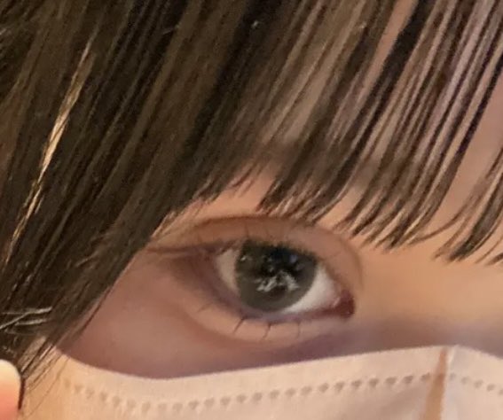 8bmnl's tweet photo. ←今
→5ヶ月前くらい！

やっと二重幅安定してきた♩
でももうちょっと幅せまくなっちゃうのかなー💭#二重 #埋没 https://t.co/WuwHvvcRTO