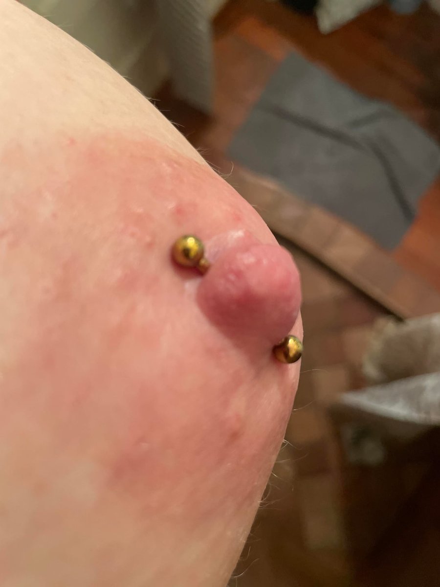 prismpierce's tweet photo. It seems you're interested in a unique and bold expression of body art! https://t.co/PkBkHWDC0y