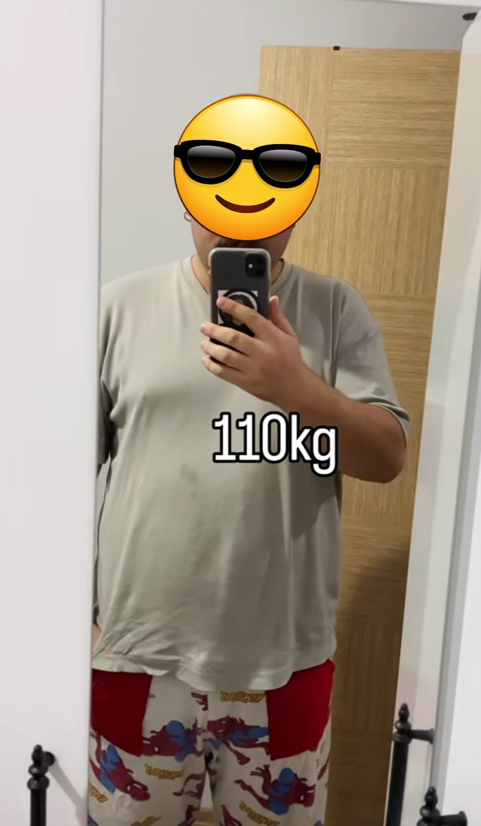ankarakamp's tweet photo. 110 kilodan nasıl 55 kiloya düştüm gösteriyorum 🫣🤭🤣🤣🤣 https://t.co/FGE4TvJSFf