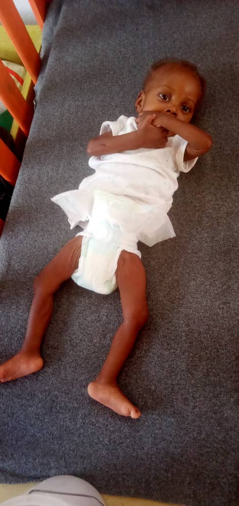 WayToHealth3's tweet photo. Our team met the Bernard baby in Nov. 2024; she was two years old and weighed 8 lbs. After close medical care provided by Way To Health, she is a healthy, happy baby! https://t.co/Rb6zgFXZjA https://t.co/BKeLqiMYhy