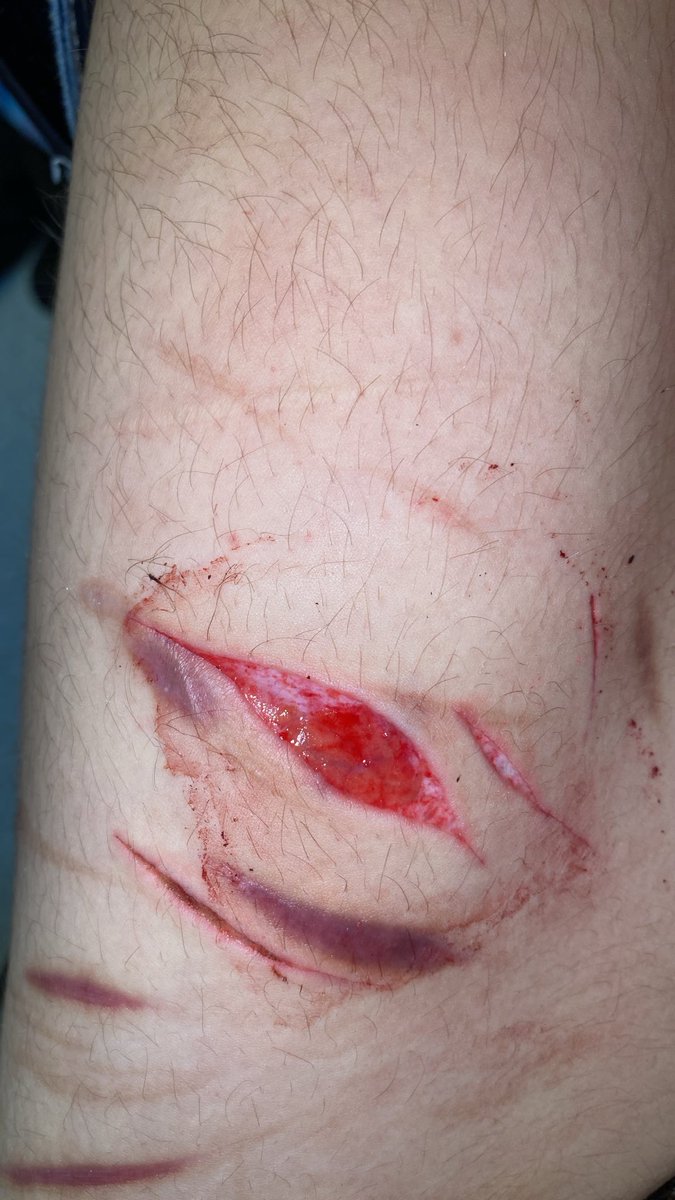 D3vastatedd4nn1's tweet photo. THIS IS MY HALLOWEEN SFX MAKEUP

NOT REAL DO NOT TRY TO RECREATE 
FOR A MOVIE ROLL https://t.co/i5mXHHDJWn