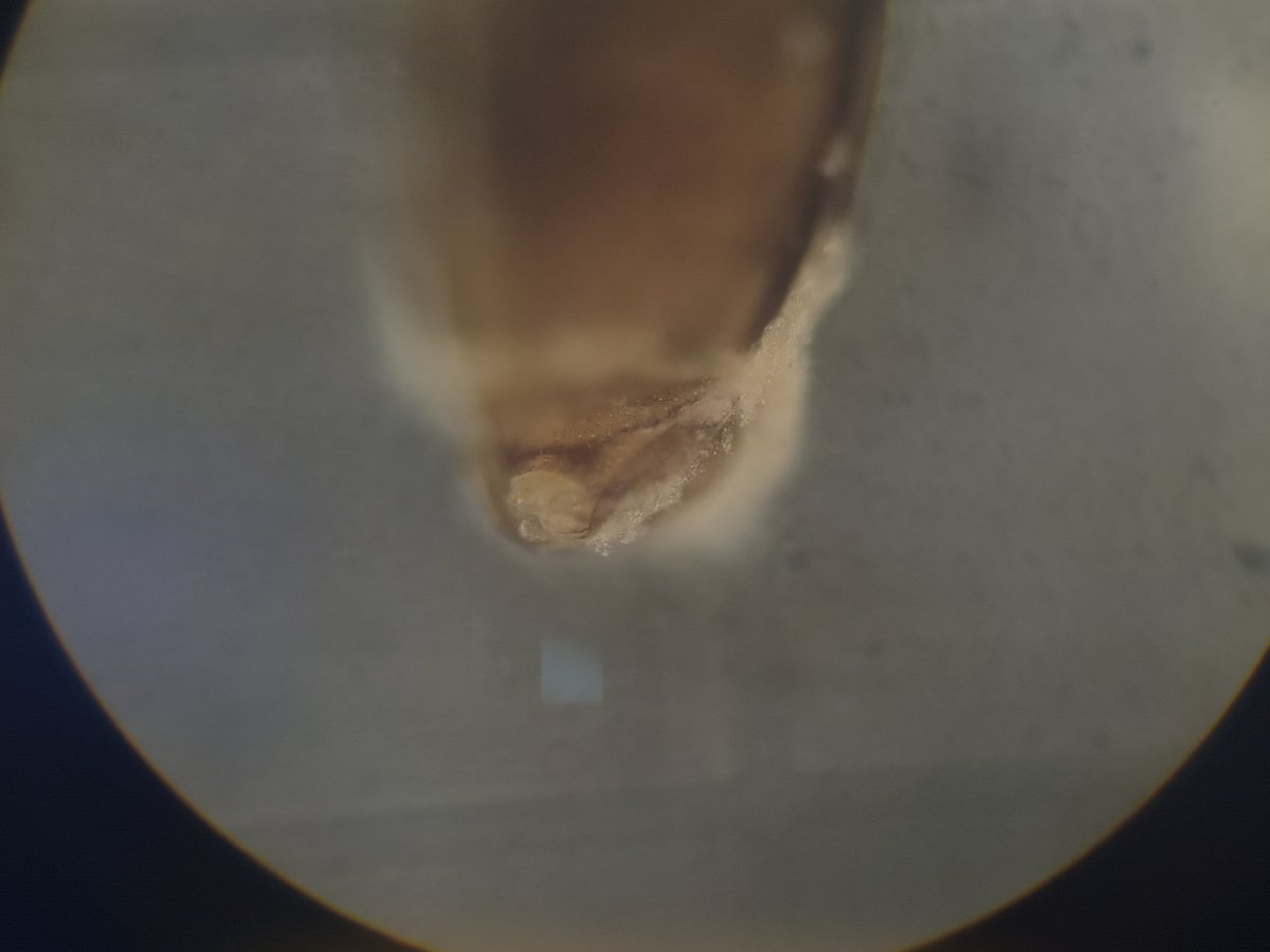 macro_tumsat's tweet photo. どなたかこの生物がどの分類群に属するものか分かる方はいらっしゃいませんか

1枚目背側, 2枚目腹側からの頭部(やや斜方から), 3枚目腹側の体節を映した動画

何卒ご協力をよろしくお願いします🙇‍♂️ https://t.co/ijUISa2csE