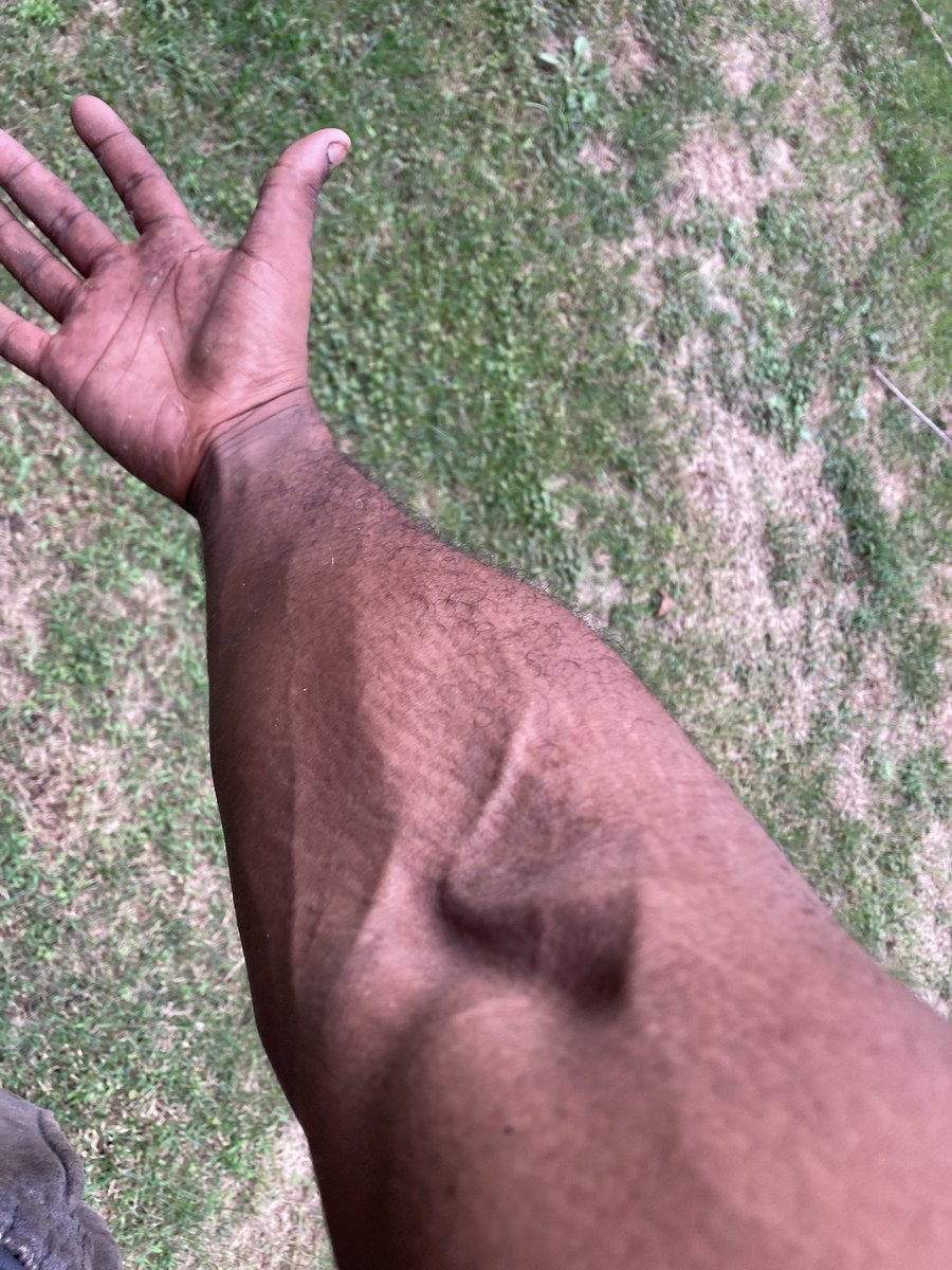 ABKKVenom's tweet photo. Veins 🕷️🩸👑🌙💨🌊 https://t.co/caBJQ5mVFr