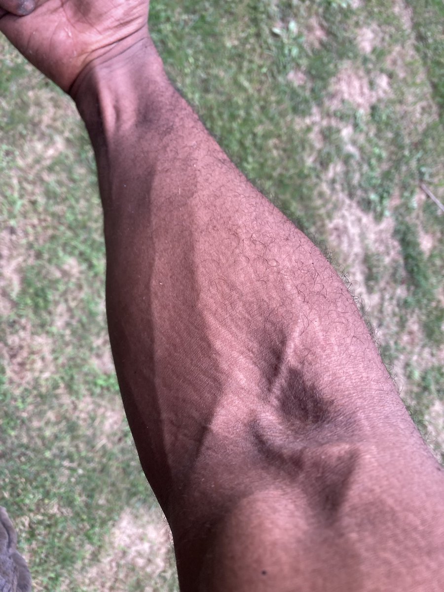 ABKKVenom's tweet photo. Veins 🕷️🩸👑🌙💨🌊 https://t.co/caBJQ5mVFr