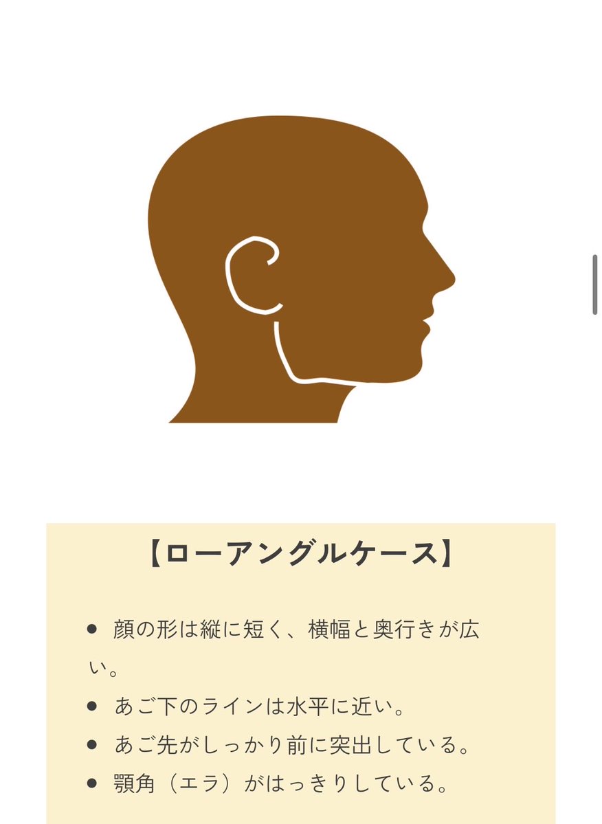 xow8owx's tweet photo. 上段のビフォーアフターなんてまさにこれなんよね

もちろんモンゴロイド・コーカソイド、遺伝由来の起因もあるんだけどさ

←before                                             after→ https://t.co/pI7wNcM1x3