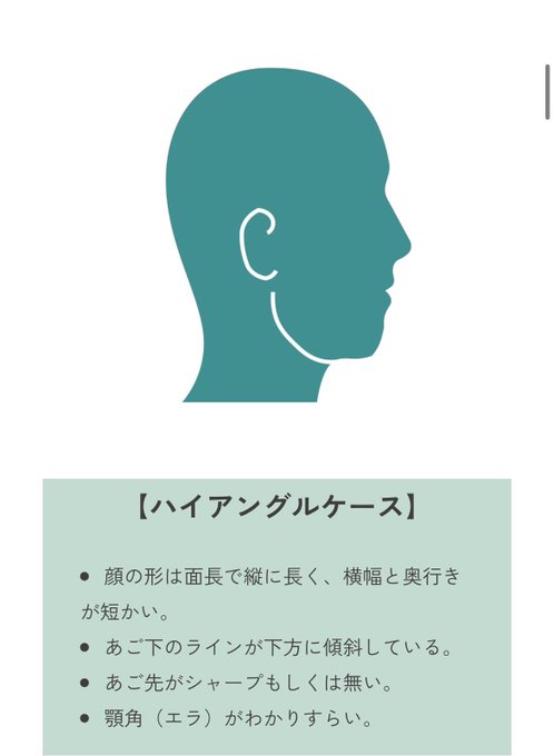 The image displays a teal silhouette of a human head in profile with a highlighted ear area, accompanied by Japanese text titled "【ハイアングルケース】" (High Angle Case) listing facial characteristics: a vertically elongated face with shorter width and depth, a downward-sloping jawline, a sharp or undefined chin tip, and a noticeable jaw angle (エラ). This relates to the post's discussion of genetic traits like Mongoloid and Caucasoid features by illustrating specific craniofacial proportions associated with a "high angle" facial structure.