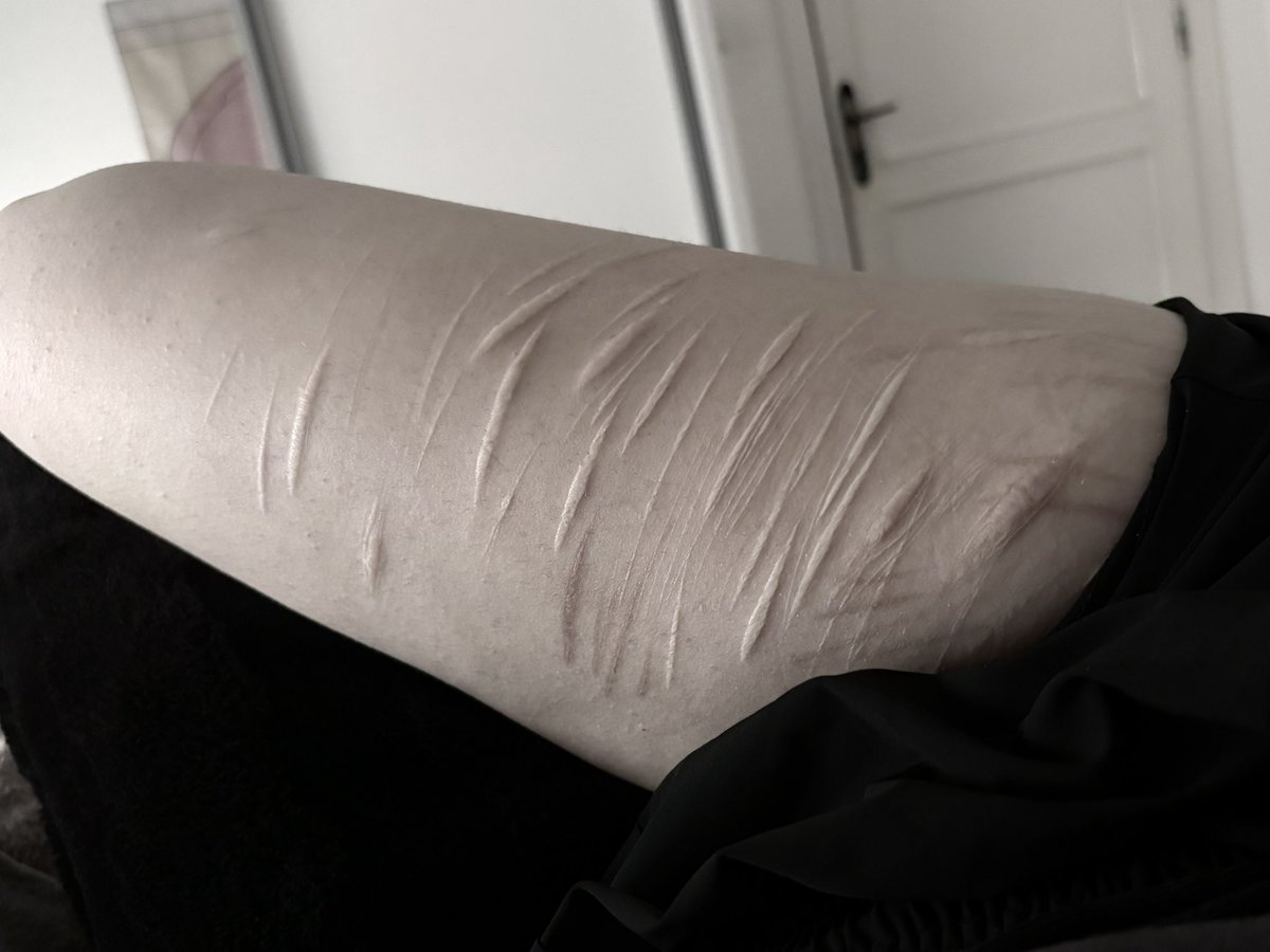 mayorofgehenna's tweet photo. she was the only one who didn’t freak out when seeing my thighs. https://t.co/MvVilnNtuf