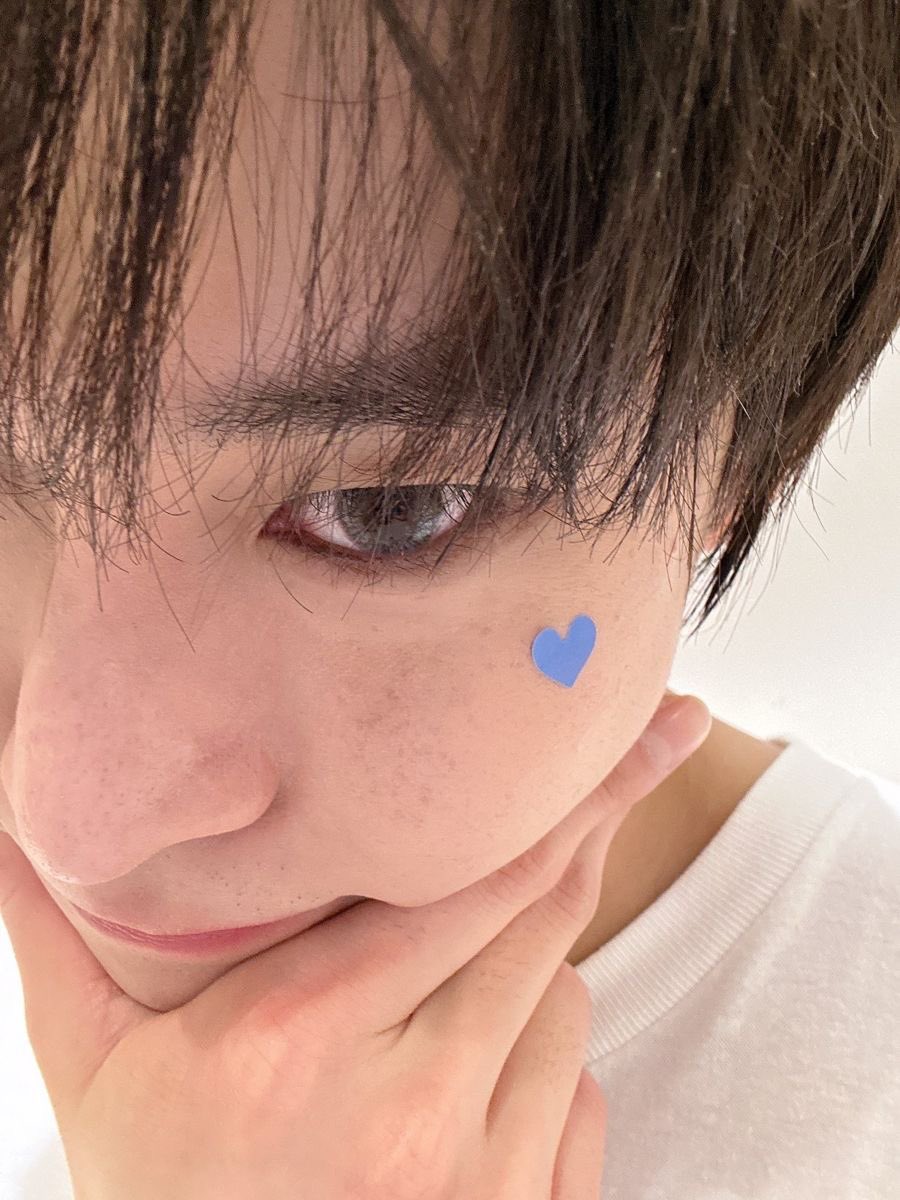 kimdiidy's tweet photo. ผงพิกซี่บนแก้มโดยองโคสจะน่าลักเยย •͈ᴗ•͈✨🎀 https://t.co/PfydkbWVTn
