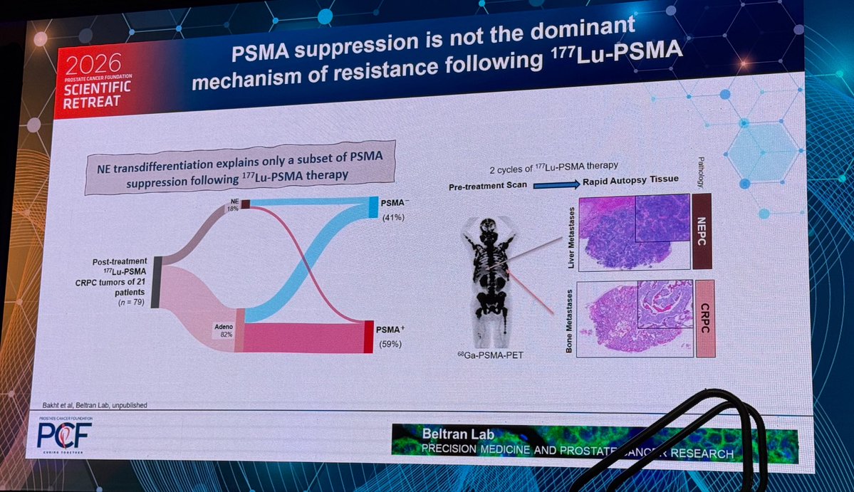 neerajaiims's tweet photo. In the @PCF_Science #PCFretreat26 , enjoyed the brilliant talk by,  @mishabeltran @DanaFarber_GU 👉Mechanism of resistance to PSMA directed RLT Rx, tips for young investigators, and the value of team science (quote from Dr. Felix Feng) @PCF_Science @urotoday @DanaFarber https://t.co/hI9eeFGJ3C