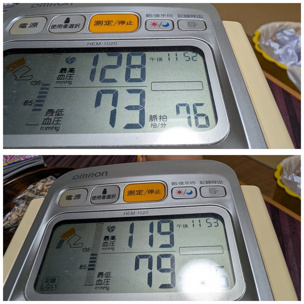 tomotamachiko's tweet photo. 2026-10-03(土)⁡
⁡お仕事🏥💊➜夜勤明け⁡
⁡🏠に帰宅したら、爆睡😪⁡
⁡起きたら、兄夫婦がきてたꉂ🤣𐤔⁡
⁡姪っ子ちゃん。🏀で膝の怪我🤕したらしい💦⁡
⁡  🌃になって、内職開始~~~‼️⁡
⁡出来る事を少しずつ💦⁡
⁡またあした(o・・o)/~⁡
⁡(*˘︶˘*)ｵﾔｽﾐﾅｻｲ~..♡♡ https://t.co/gJIr8JataF