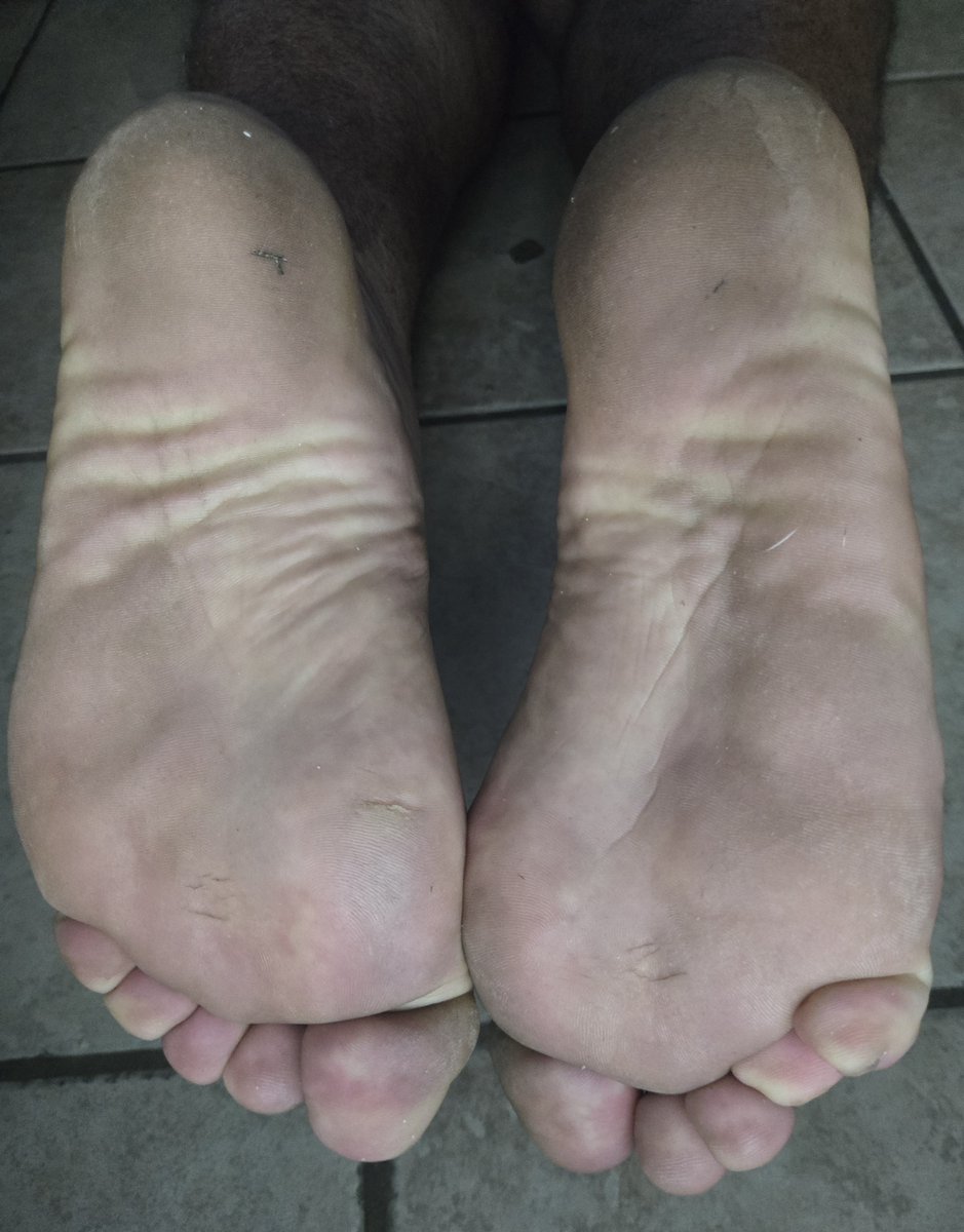 ChunkyPads's tweet photo. FAT SOLES Before 🤭 &amp; After 😈 Saturday Morning Barefoot Walk. Which do you prefer?
[10.5-11 US, 6'2", 300LB]
#MeatyFeet #ChubbyFeet #WideFeet #MaleSoles #FootFetish #BearFeet https://t.co/3eqWqTAxbW
